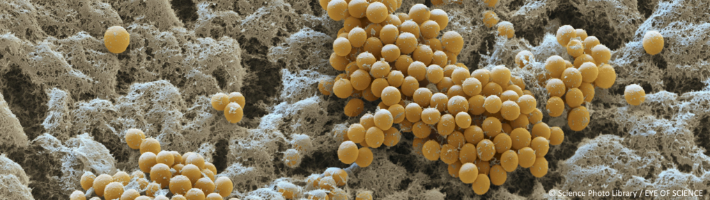 Fruiting body morphology & evolution