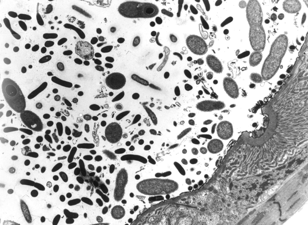 Bacterial symbionts of termite gut flagellates