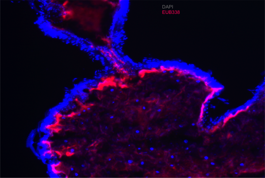 Diversity and evolution of the termite gut microbiota